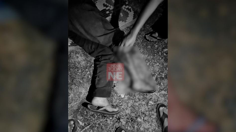 Manipur violence: Unknown assailants shoot man in leg in Thoubal district Manipur violence: Unknown assailants shoot man in leg in Thoubal district