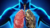 Understanding Respiratory Diseases: Causes, Symptoms and Management Understanding Respiratory Diseases: Causes, Symptoms and Management