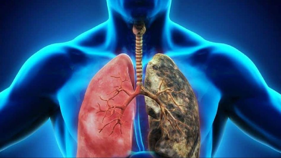 Understanding Respiratory Diseases: Causes, Symptoms and Management Understanding Respiratory Diseases: Causes, Symptoms and Management