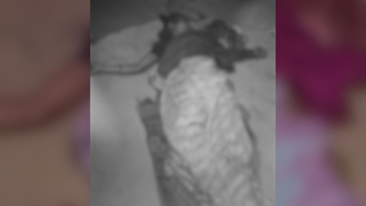 Assam: Woman allegedly beaten to death by family members in Digboi, accused arrested Assam: Woman allegedly beaten to death by family members in Digboi, accused arrested