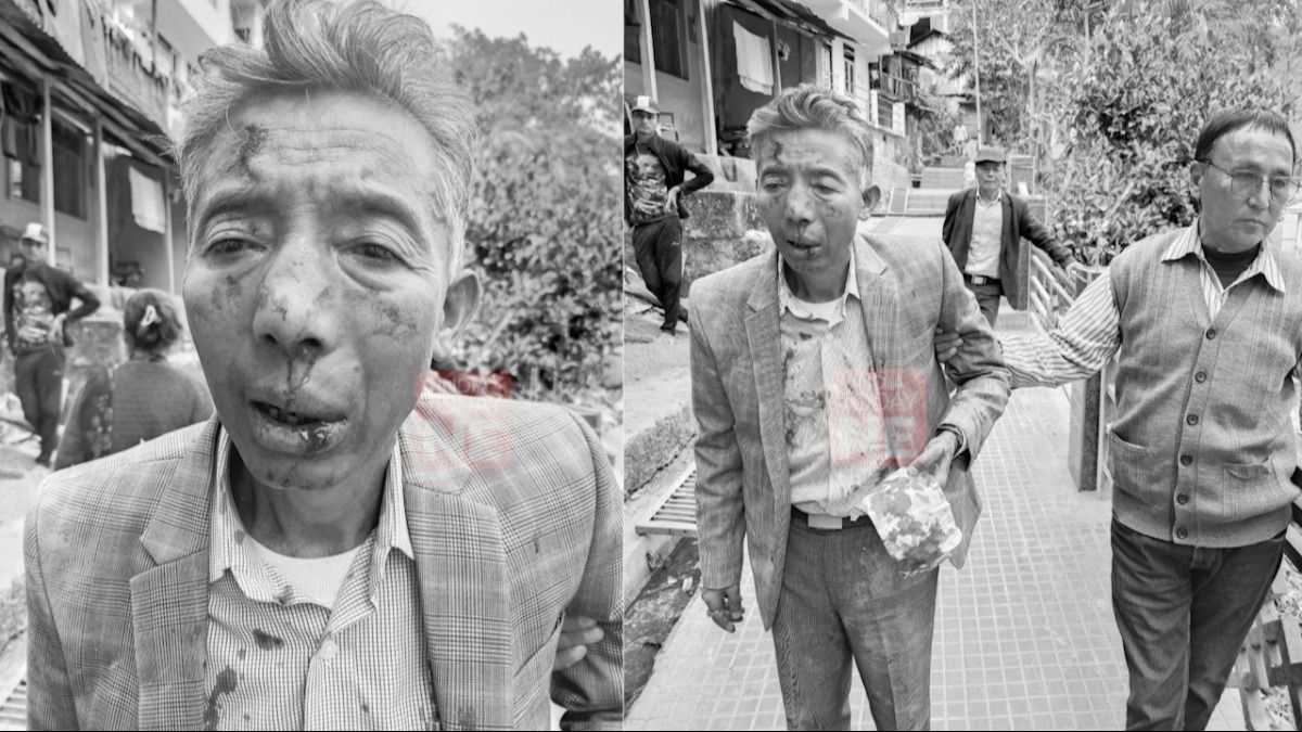 Sikkim: Senior SDF leader brutally attacked allegedly by SKM workers Sikkim: Senior SDF leader brutally attacked allegedly by SKM workers