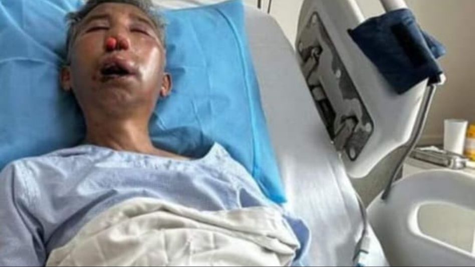 Sikkim: Health condition of SDF leader KN Rai stable, says hospital official Sikkim: Health condition of SDF leader KN Rai stable, says hospital official