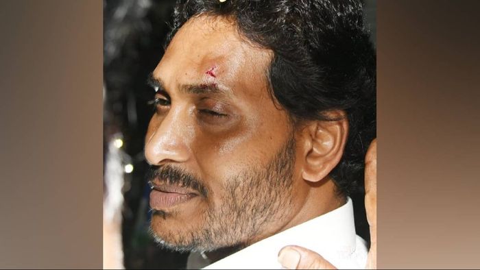 Andhra Chief Minister Jagan Mohan Reddy injured after stones thrown during roadshow