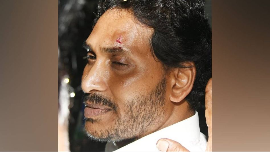 Andhra Chief Minister Jagan Mohan Reddy injured after stones thrown during roadshow Andhra Chief Minister Jagan Mohan Reddy injured after stones thrown during roadshow