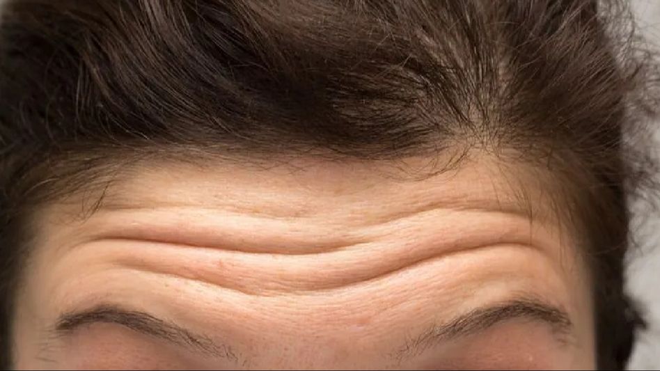 Wrinkle-Free Wonders: Home Remedies for Treating and Preventing Wrinkles Wrinkle-Free Wonders: Home Remedies for Treating and Preventing Wrinkles