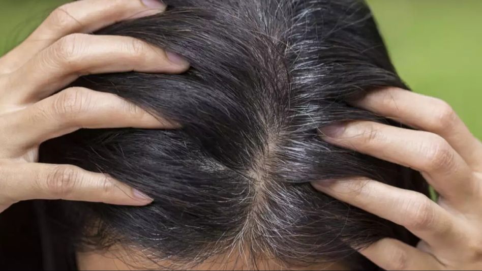 Gray No More: Natural Remedies to Tackle Greying Hair at Home Gray No More: Natural Remedies to Tackle Greying Hair at Home