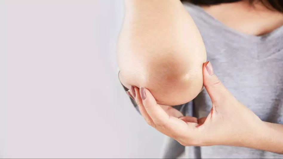 Brighten Your Elbows: Effective Home Remedies for Lightening Dark Elbows Brighten Your Elbows: Effective Home Remedies for Lightening Dark Elbows