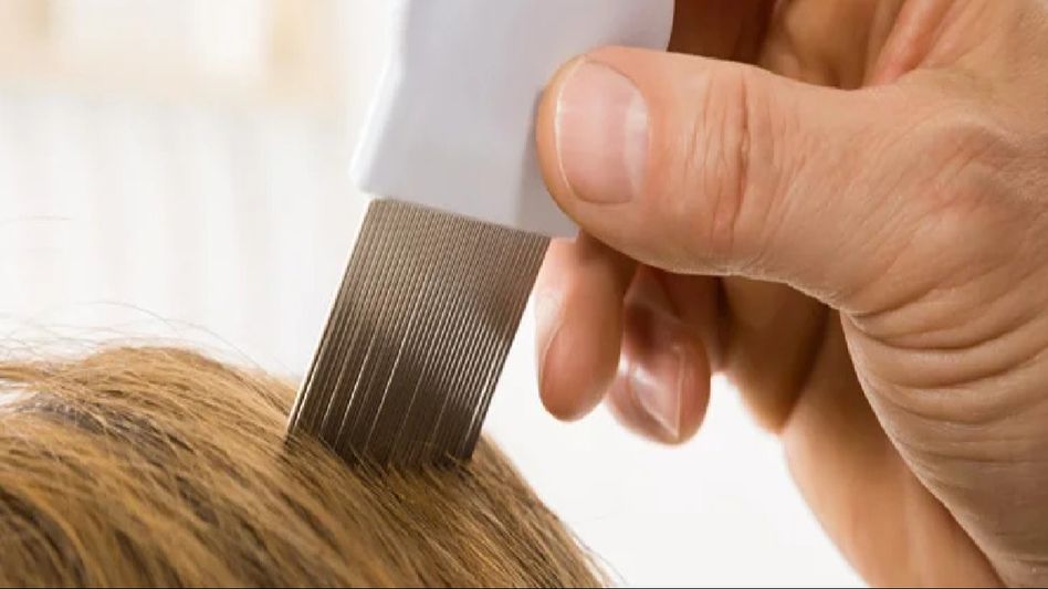 Natural Remedies for Treating Excessive Lice Infestation on the Head Natural Remedies for Treating Excessive Lice Infestation on the Head