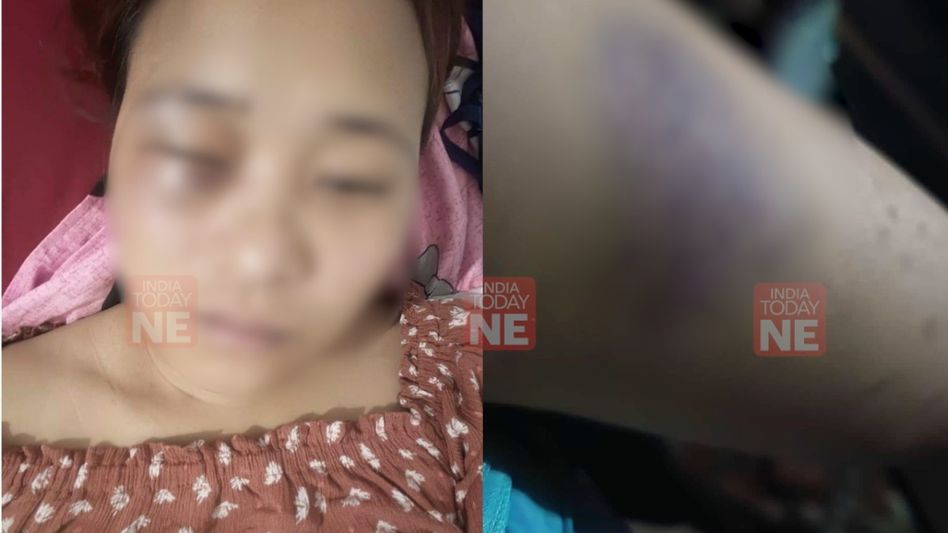 Woman files complaint against Arunachal student body member over 'molestation' Woman files complaint against Arunachal student body member over 'molestation'