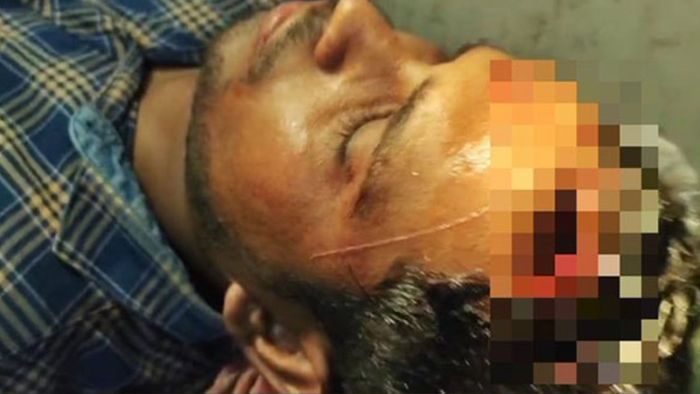 Journalist injured amid poll clashes in West Bengal (Credit: ANI)