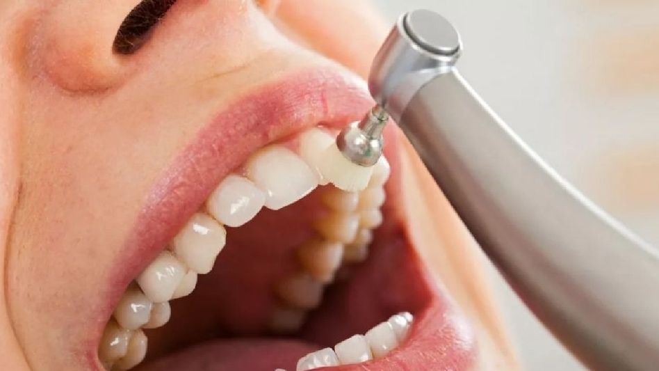 Brighten Your Smile: Natural Methods to Remove Yellowish Stains from Teeth Brighten Your Smile: Natural Methods to Remove Yellowish Stains from Teeth