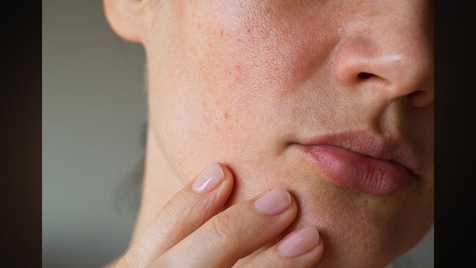 Revitalizing Your Skin: Summer Strategies for Rejuvenating Dull Skin Revitalizing Your Skin: Summer Strategies for Rejuvenating Dull Skin