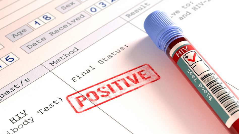 Tripura government issues clarification after reports claim 828 HIV cases in state Tripura government issues clarification after reports claim 828 HIV cases in state