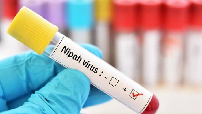 Kerala reports Nipah virus case in 14-year-old from Malappuram