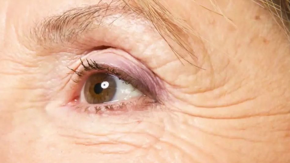 The Battle Against Time: Escaping Fast-Advancing Wrinkles The Battle Against Time: Escaping Fast-Advancing Wrinkles