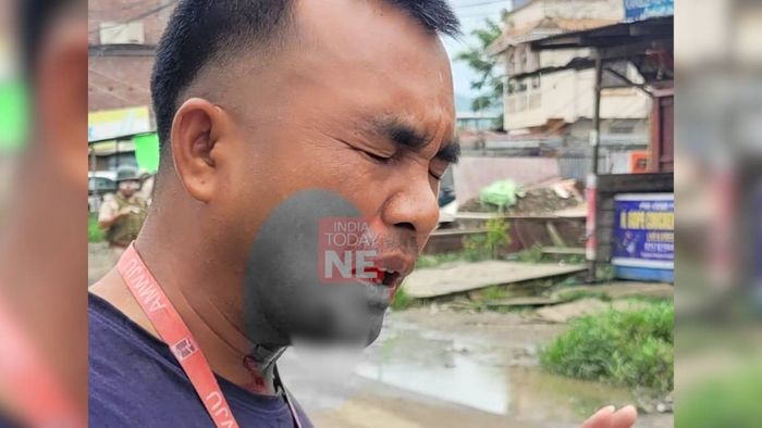 Manipur journalist assaulted by Police during IDP protest coverage, media fraternity demands action