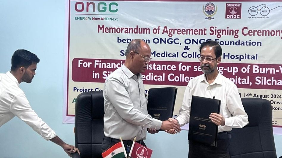Assam: ONGC allocates Rs 13.56 crore for advanced burn ward at Silchar Medical College Assam: ONGC allocates Rs 13.56 crore for advanced burn ward at Silchar Medical College