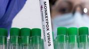 India on alert as global Mpox cases rise India on alert as global Mpox cases rise