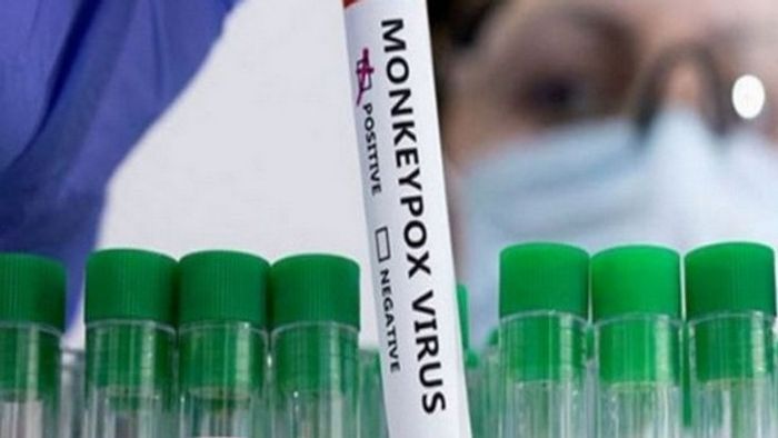 India on alert as global Mpox cases rise