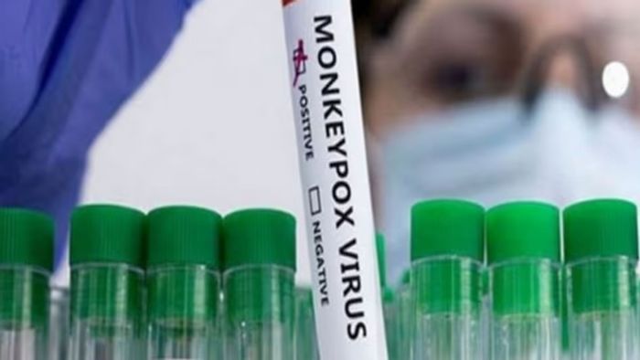 Suspected Mpox cases in Manipur test negative