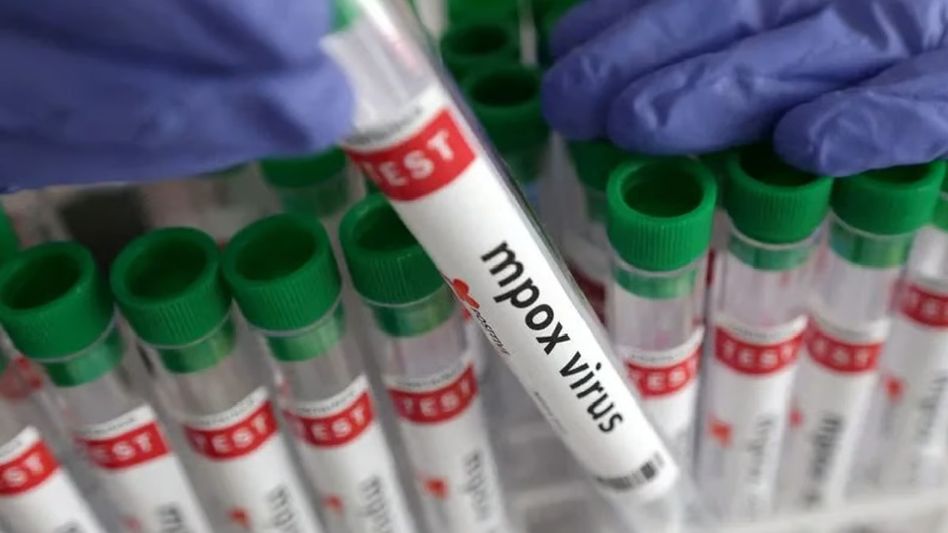 India detects first suspected Mpox case, patient stable India detects first suspected Mpox case, patient stable