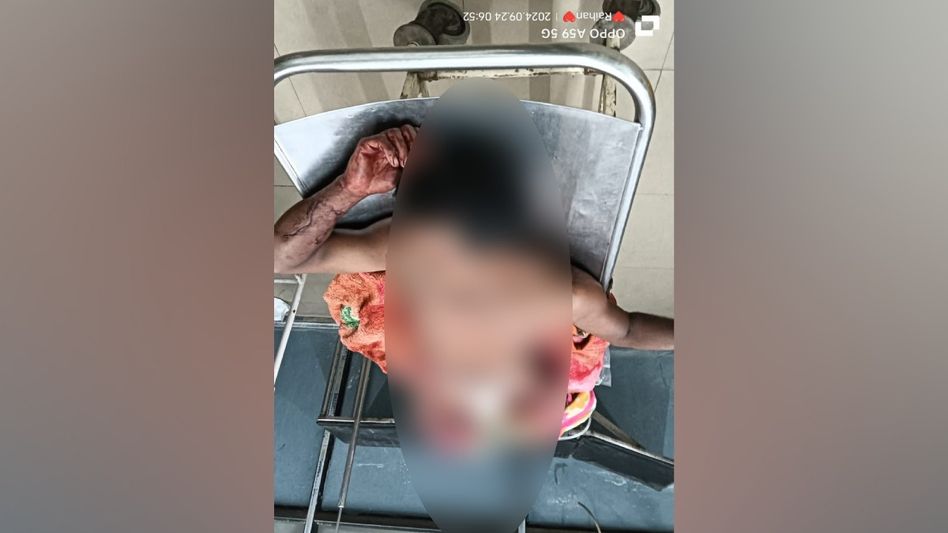 Assam: Woman chops off brother-in-law's genitals over alleged illicit affair in Bajali Assam: Woman chops off brother-in-law's genitals over alleged illicit affair in Bajali