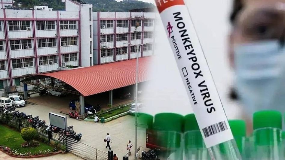 Assam: GMCH Superintendent denies Monkeypox case, confirms Chickenpox instead Assam: GMCH Superintendent denies Monkeypox case, confirms Chickenpox instead