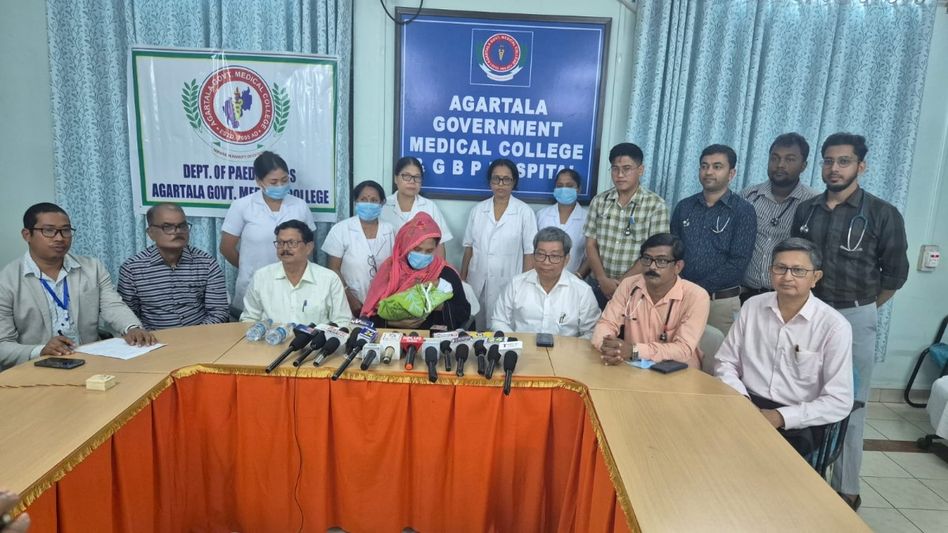 Tripura: Premature baby weighing just 670 grams survives at Agartala hospital Tripura: Premature baby weighing just 670 grams survives at Agartala hospital