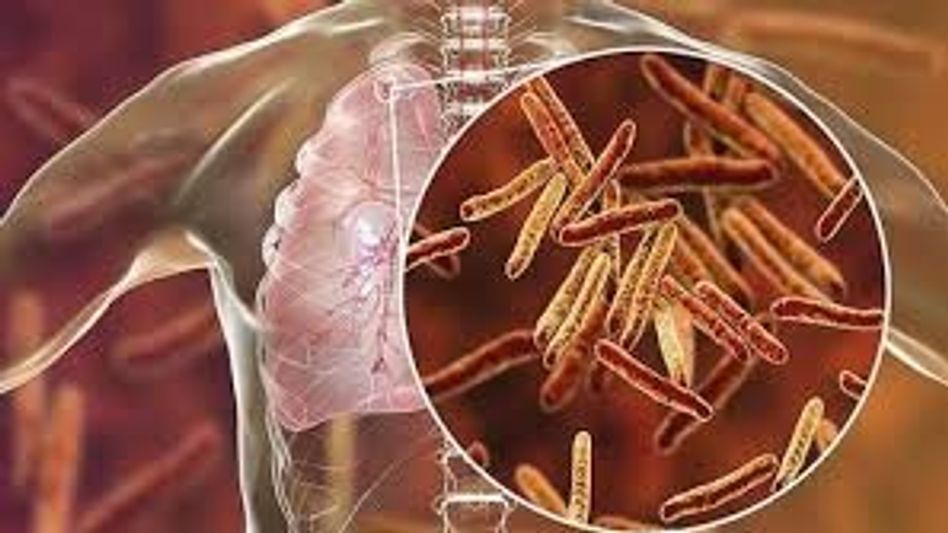 Nagaland launches 100-day intensified campaign to eliminate TB by 2025 Nagaland launches 100-day intensified campaign to eliminate TB by 2025