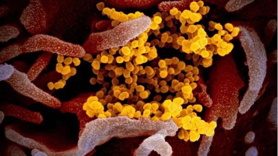 Assam: 10-month-old tests positive for HMPV in Dibrugarh; first case in state for 2025 Assam: 10-month-old tests positive for HMPV in Dibrugarh; first case in state for 2025