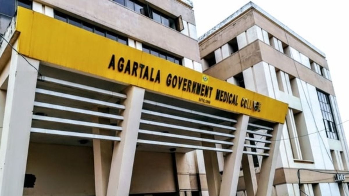 Tripura's first liver transplant centre to open soon at state medical college