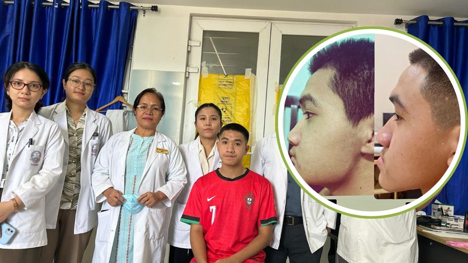 TRIHMS performs Arunachal's first bi jaw orthognathic surgery TRIHMS performs Arunachal's first bi jaw orthognathic surgery