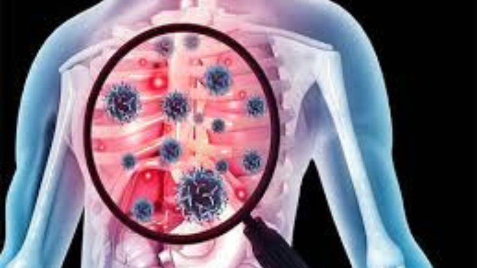 44 dead, 1,492 diagnosed with TB in Mizoram this year 44 dead, 1,492 diagnosed with TB in Mizoram this year