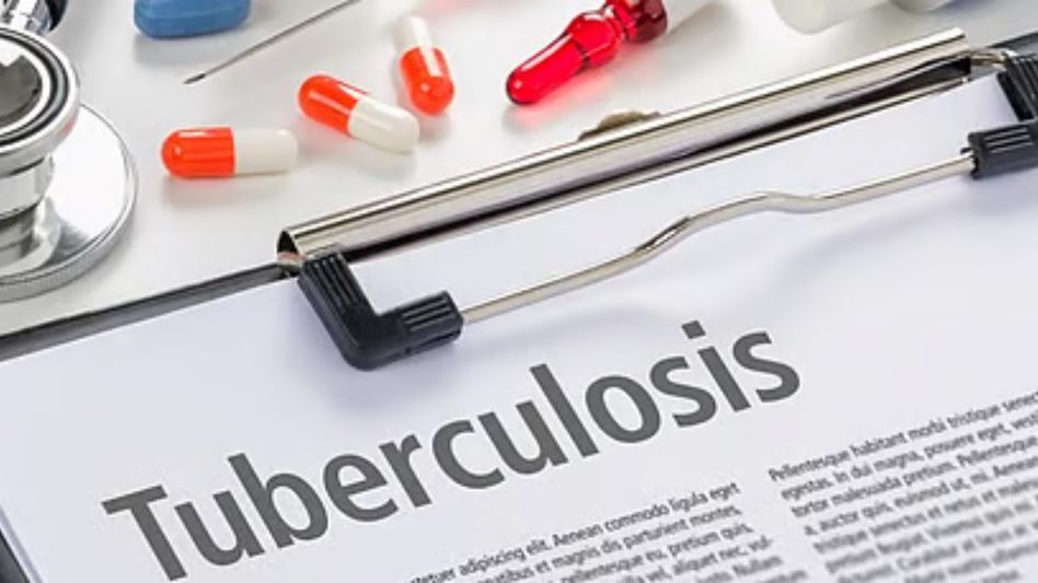 121 people die of TB in Mizoram since January, health department reports 121 people die of TB in Mizoram since January, health department reports