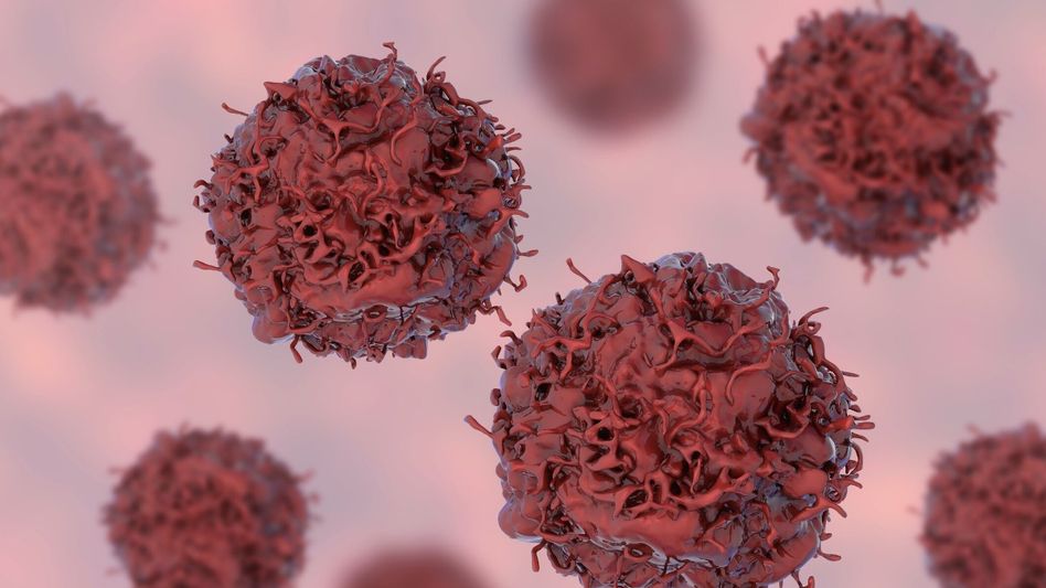 Uneven rise in India’s cancer research highlights global disparities: Study Uneven rise in India’s cancer research highlights global disparities: Study