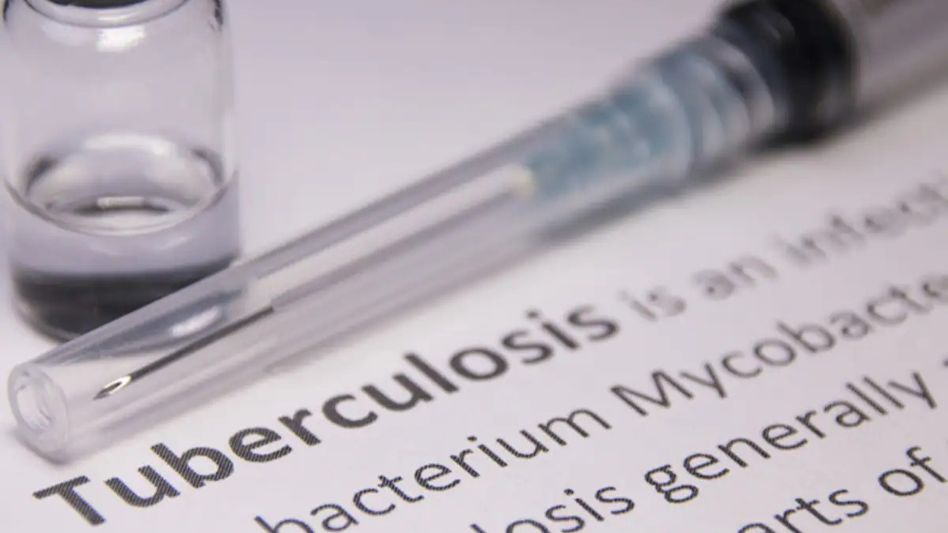 Mizoram records highest TB deaths in six years with 145 fatalities in 2025 Mizoram records highest TB deaths in six years with 145 fatalities in 2025