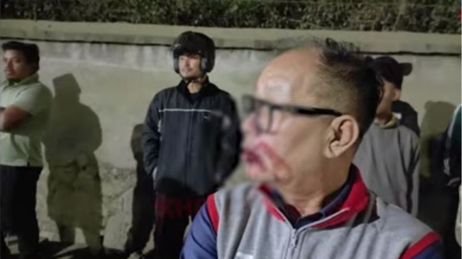 Arunachal journalists’ union condemns attack on Manipur editor Arunachal journalists’ union condemns attack on Manipur editor