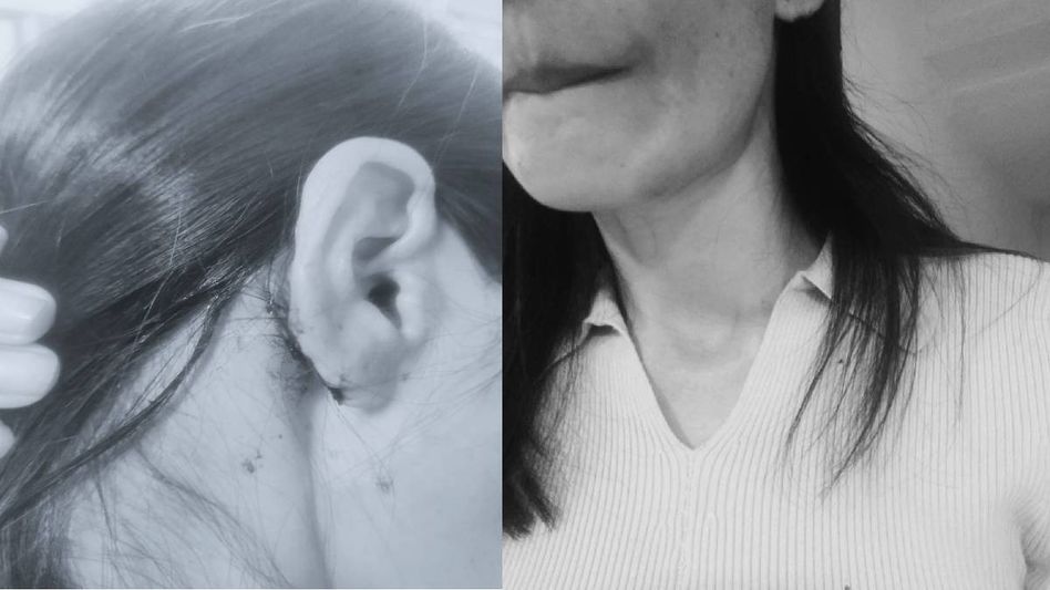 Days after outrage over racism, Manipur woman allegedly assaulted in South Delhi park after resisting racial slurs Days after outrage over racism, Manipur woman allegedly assaulted in South Delhi park after resisting racial slurs