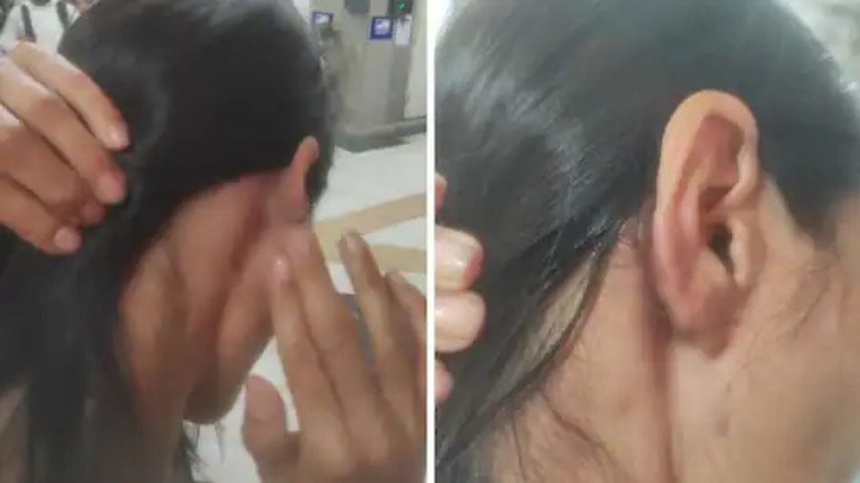 NHRC seeks report from Delhi Police over assault on Manipur woman NHRC seeks report from Delhi Police over assault on Manipur woman