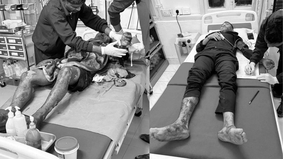 Grenade attack on Assam police camp leaves four injured in Tinsukia Grenade attack on Assam police camp leaves four injured in Tinsukia