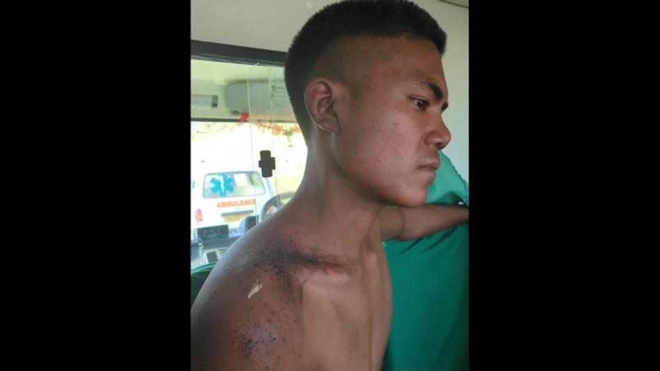 Manipur’s Mongkot Chepu village alleges repeated militant firing, urges government intervention Manipur’s Mongkot Chepu village alleges repeated militant firing, urges government intervention