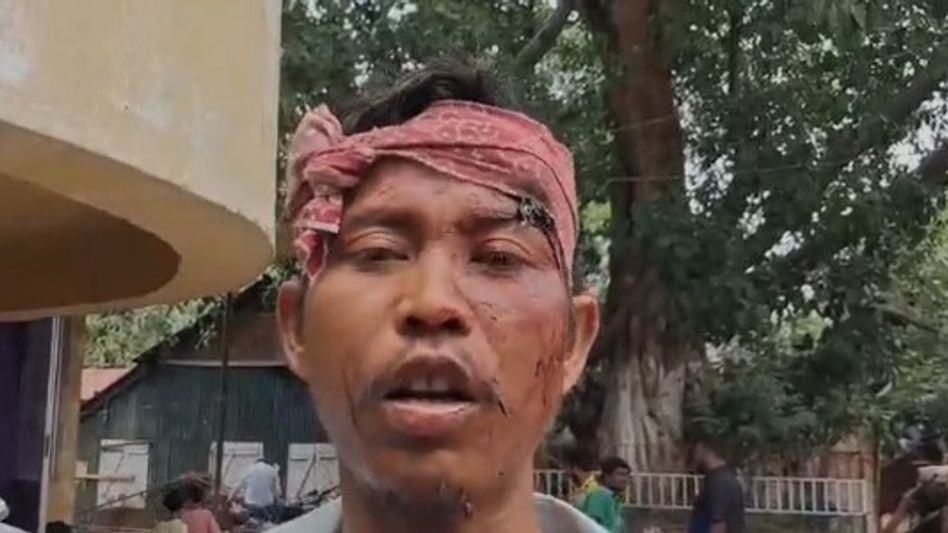 Youth beaten with stick over singing Zubeen Garg song in Guwahati Youth beaten with stick over singing Zubeen Garg song in Guwahati