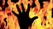 8-year-old boy dies of burn injuries in Assam's Goalpara 8-year-old boy dies of burn injuries in Assam's Goalpara