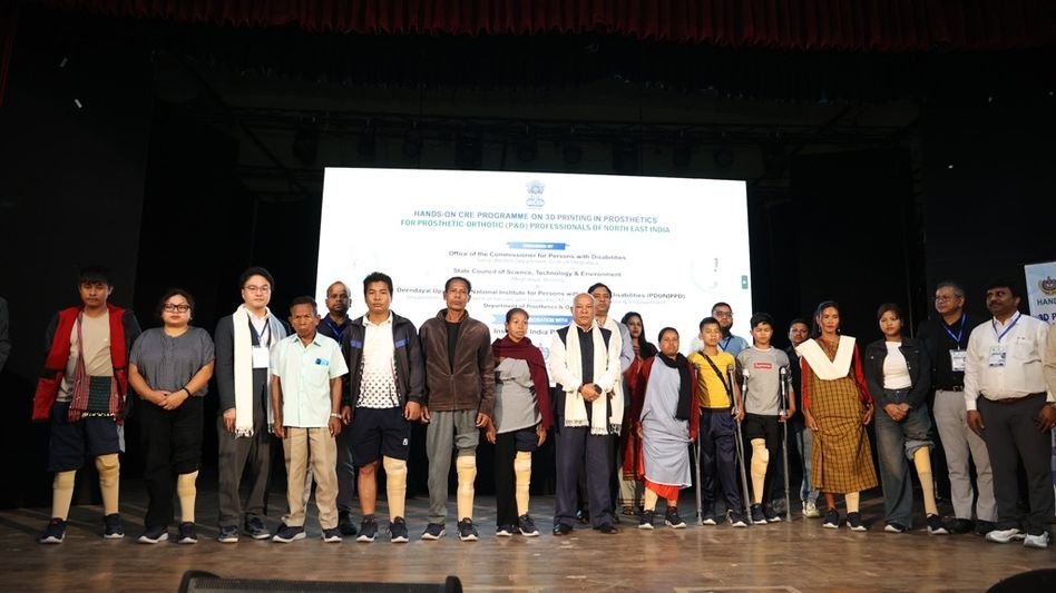 Meghalaya launches 3D prosthetic training, provides artificial limbs to 12 amputees Meghalaya launches 3D prosthetic training, provides artificial limbs to 12 amputees