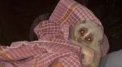 Endangered Bengal Slow Loris rescued after being found injured in Assam's Karbi Anglong Endangered Bengal Slow Loris rescued after being found injured in Assam's Karbi Anglong