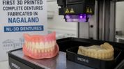 Nagaland fabricates first 3D-printed complete dentures Nagaland fabricates first 3D-printed complete dentures