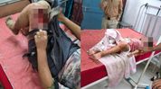 Fresh violence in Manipur's Kangpokpi leaves woman, child injured Fresh violence in Manipur's Kangpokpi leaves woman, child injured