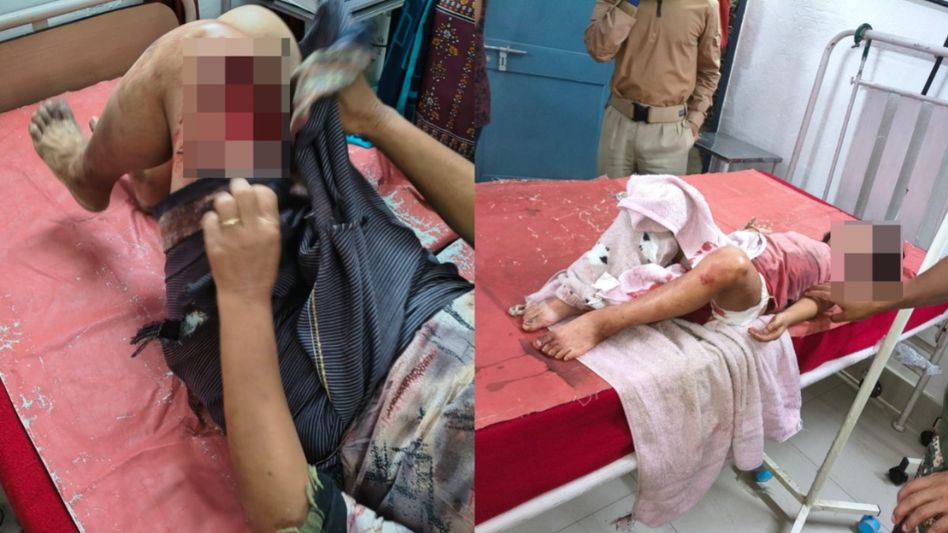 Fresh violence in Manipur's Kangpokpi leaves woman, child injured Fresh violence in Manipur's Kangpokpi leaves woman, child injured