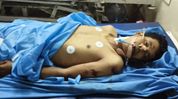 Assam youth dies at Hyderabad worksite, family seeks help Assam youth dies at Hyderabad worksite, family seeks help