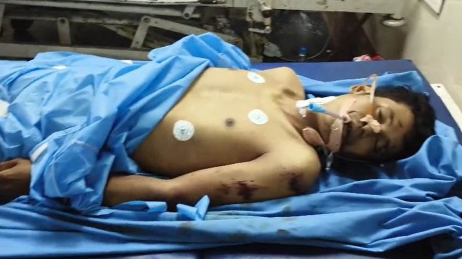 Assam youth dies at Hyderabad worksite, family seeks help Assam youth dies at Hyderabad worksite, family seeks help
